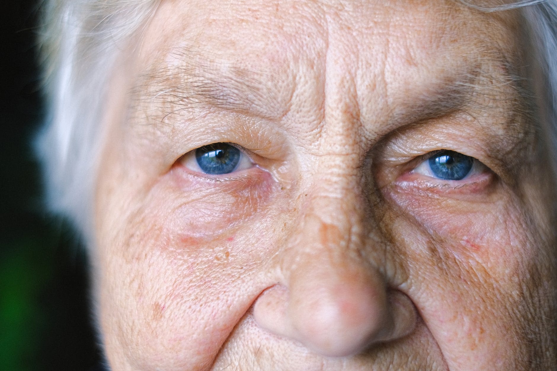 A missing Battersea elderly woman is being appealed for